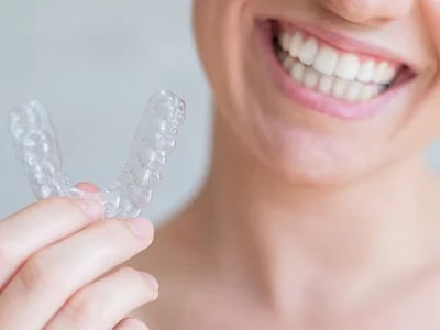 Den Behandlungsprozess mit transparenten Alignern verstehen