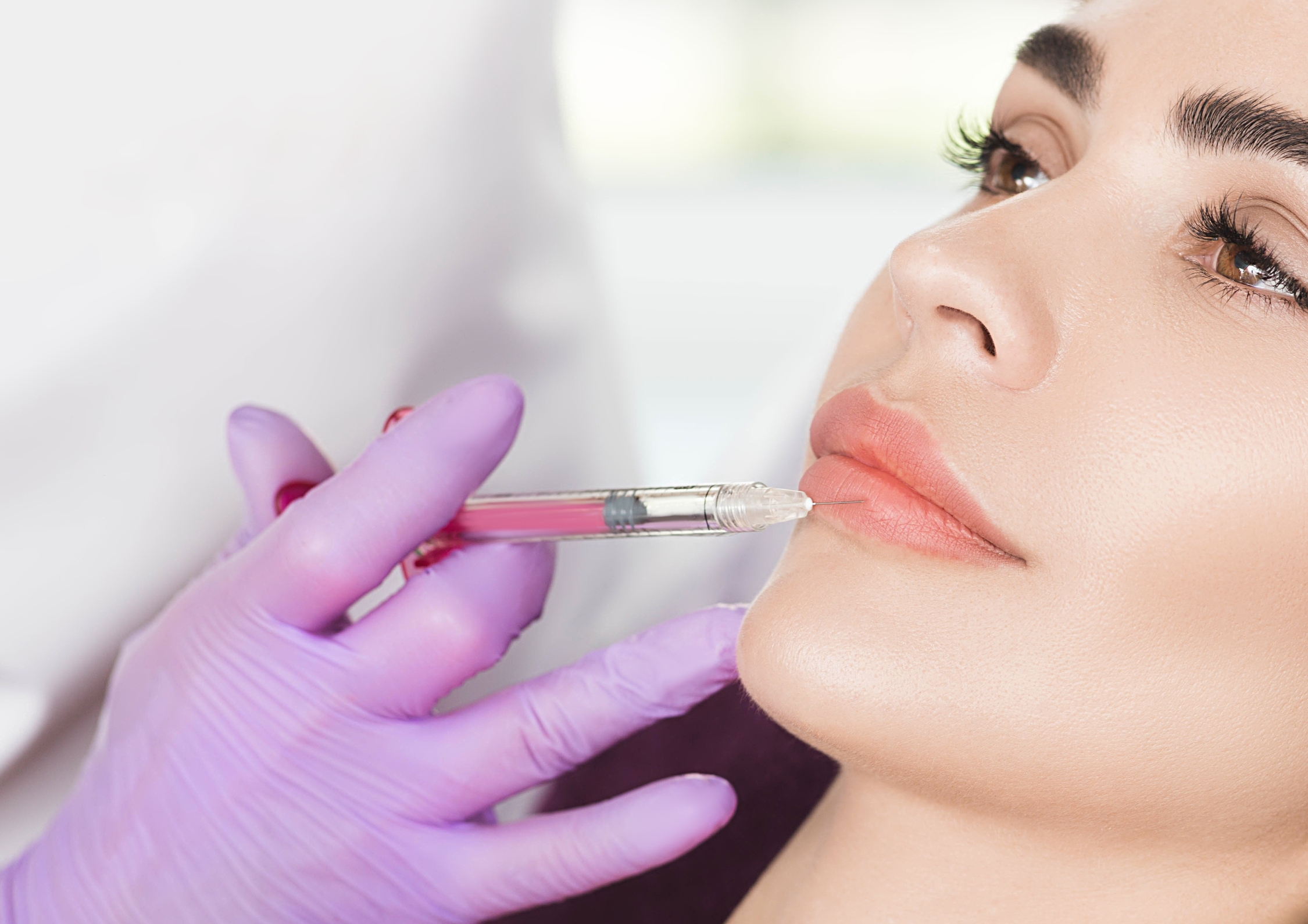 Erleben Sie die besten Ergebnisse mit Lippen Aufspritzen Nürnberg: Moderne ästhetische Behandlungen bei MY AESTHETICS